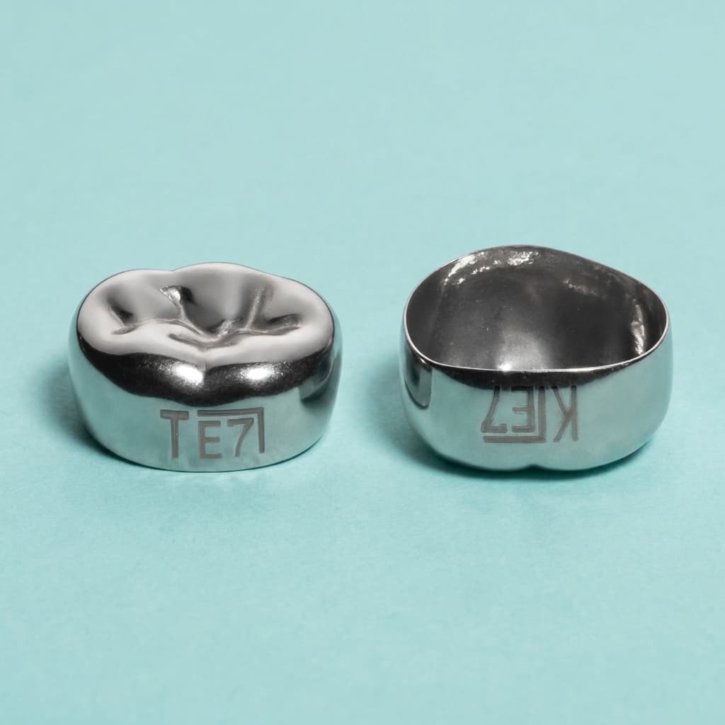 Stainless steel molar crown, exterior and interior