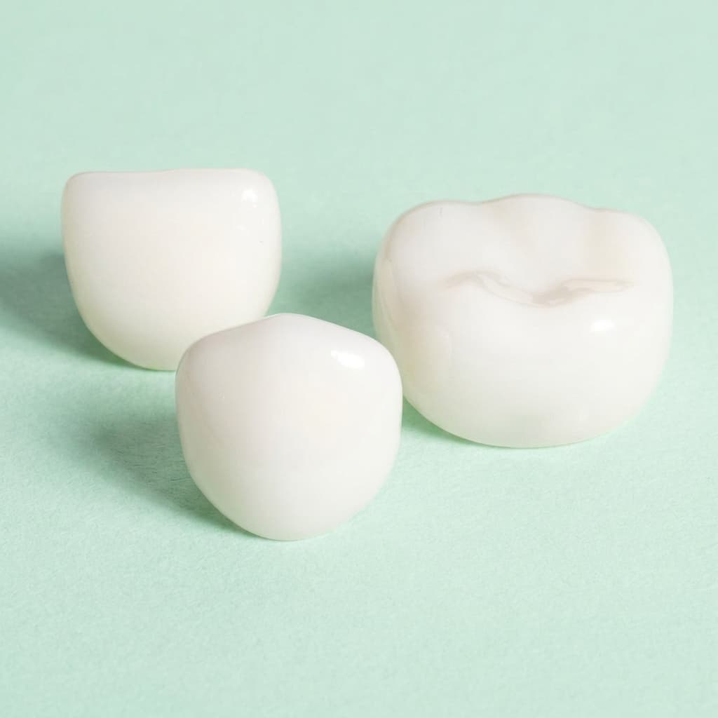 Zirconia incisor and molar crowns