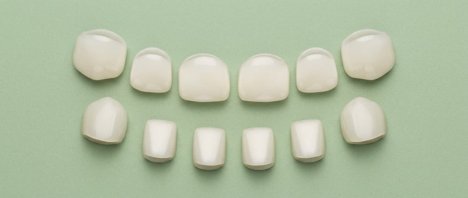 KTR zirconia anterior crowns, upper and lower
